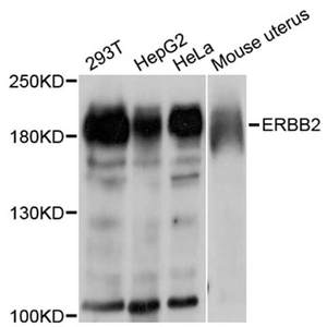 Anti-ErbB2 Polyclonal Antibody