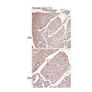 Anti-PPP4C Polyclonal Antibody