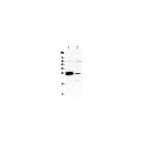 Anti-GSTA1/A2/A3/A4/A5 Antibody,500 ug/ml