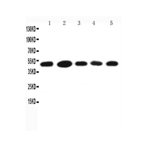 Anti-ST13 Antibody,500 ug/ml