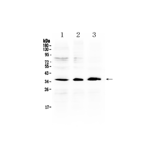 Anti-AKR1B10 Antibody,500 ug/ml