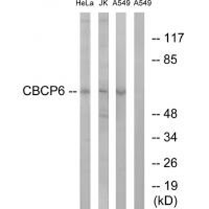 Anti-AGBL4 Antibody,500 ug/ml