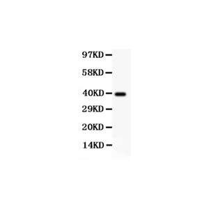 Anti-CCNB1 Antibody,500 ug/ml