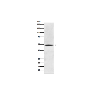 Anti-CAMK2A Antibody,500 ug/ml