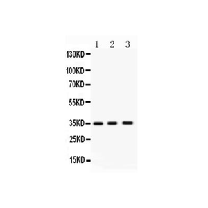 Anti-NKX2-5 Antibody,500 ug/ml