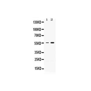 Anti-MEF2A Antibody,500 ug/ml