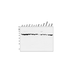 Anti-PIAS2 Antibody,500 ug/ml