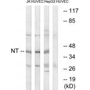 Anti-NTM Antibody,500 ug/ml