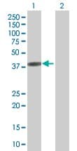 GRAP2 overexpression 293T裂解物(whole cell) (ab94235)