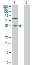 Anti-Poliovirus Receptor/PVR抗体(ab103630)