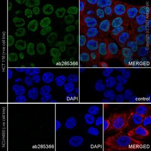 重组Anti-TZP抗体[EPR25998-35] - BSA and Azide free (ab285369)