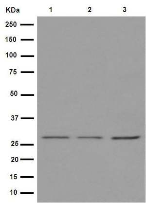 重组Anti-ANP32C/PP32R1抗体[EPR13354-70R] - BSA and Azide free (ab251006)