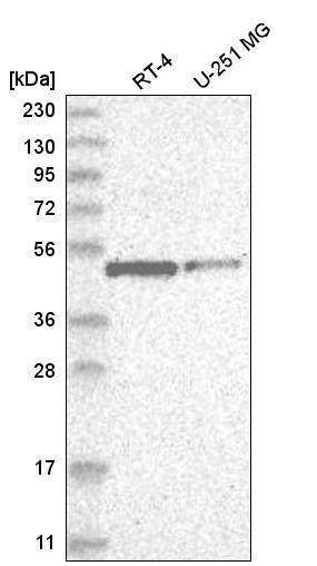 Anti-ATP7b抗体(ab262896)