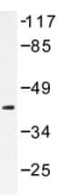 Anti-Creatine Kinase MM抗体(ab189438)