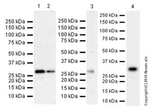 重组Anti-FHL1抗体[EPR22842-95] (ab255828)