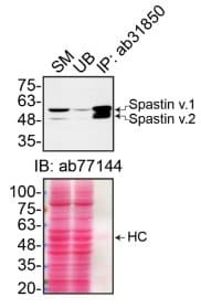 Anti-Spastin抗体[Sp 3G11/1] (ab31850)