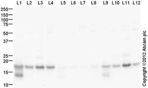 Anti-Histone H3 (mono methyl K56)抗体(ab66857)