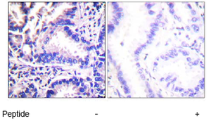 Anti-gamma Synuclein/SNCG抗体(ab55424)